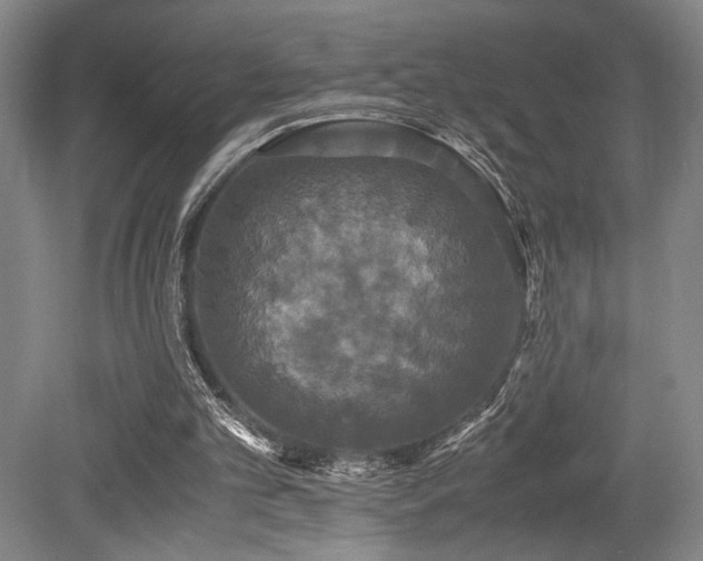 X0000079320101200611171133