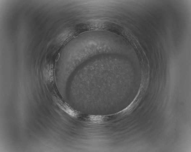 X0000079320144200611171133