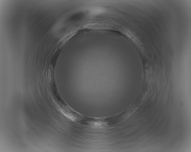 X0000079320165200611171132