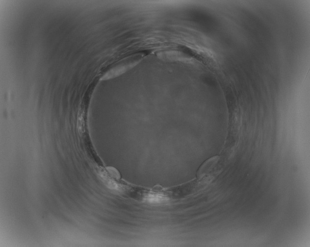 X0000079320177200611171132