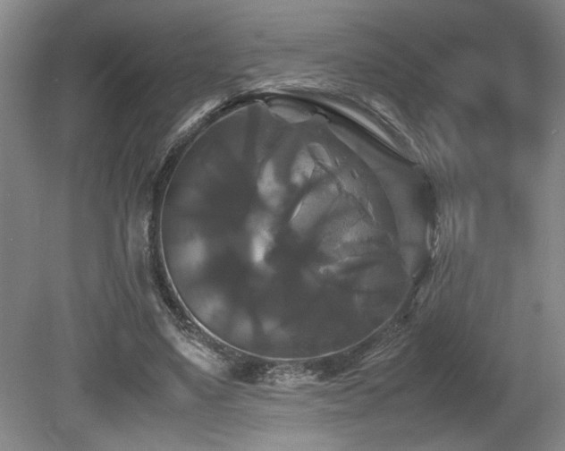 X0000079320491200611171127
