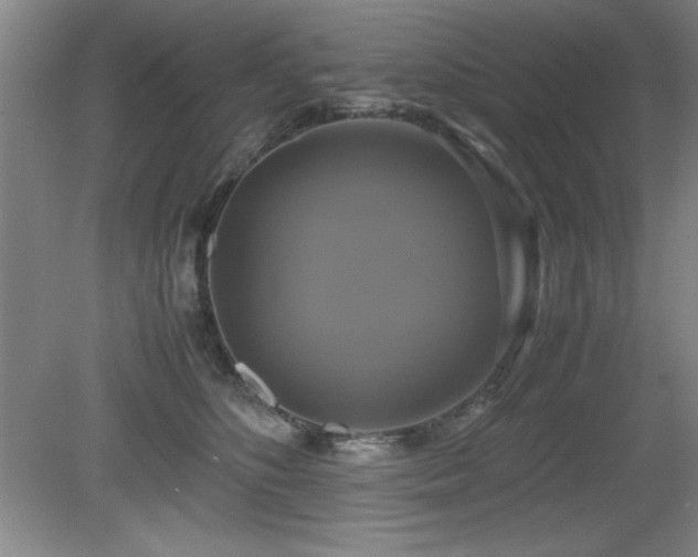 X0000079320516200611171126
