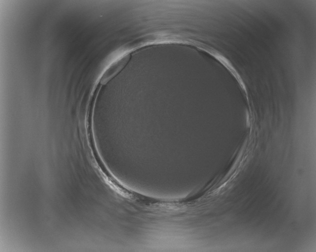 X0000079321197200611171115