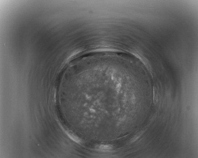 X0000079320157200611251813