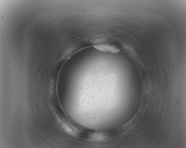 X0000079320171200611251814