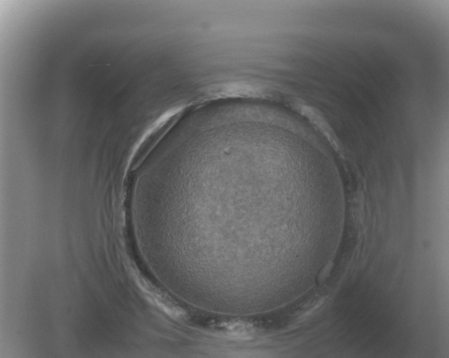 X0000079320395200611251810