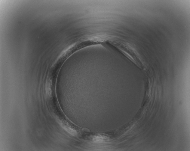 X0000079320400200611251810