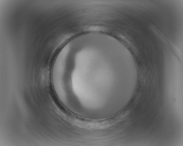 X0000079320016200612011854