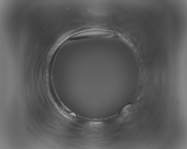 X0000079320055200612011852