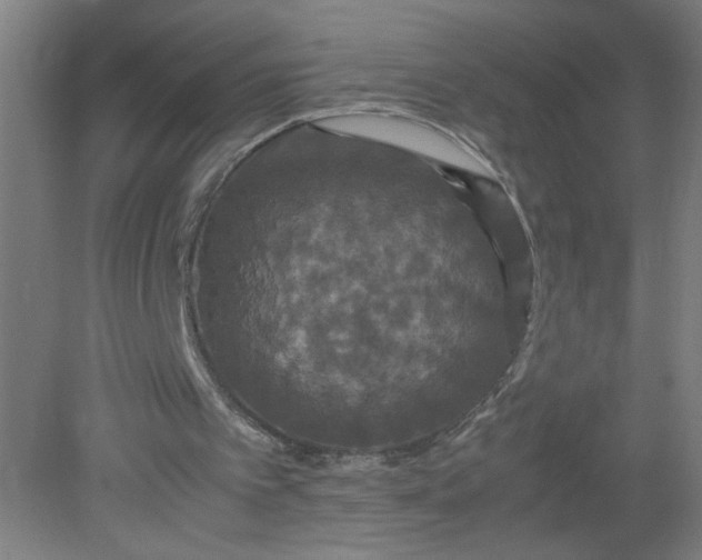 X0000079320097200612011852