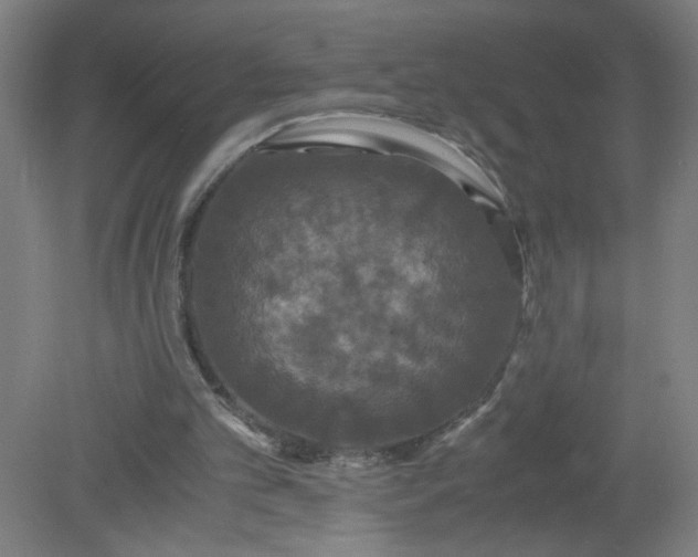 X0000079320101200612011852