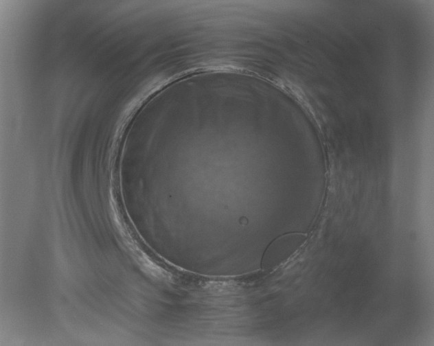 X0000079320145200612011851