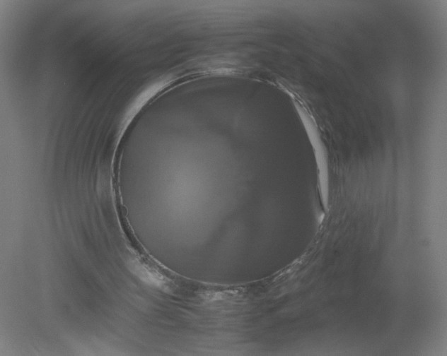 X0000079320147200612011851