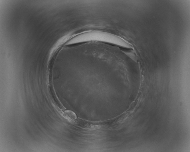 X0000079320149200612011851