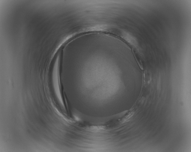 X0000079320156200612011851