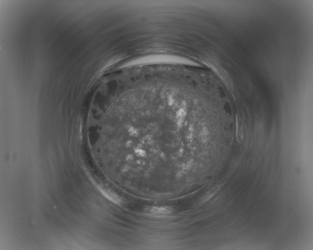 X0000079320157200612011851