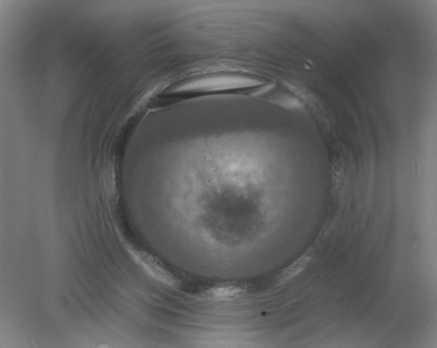 X0000079320158200612011851