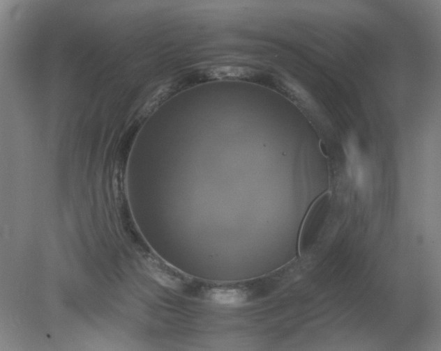 X0000079320169200612011851