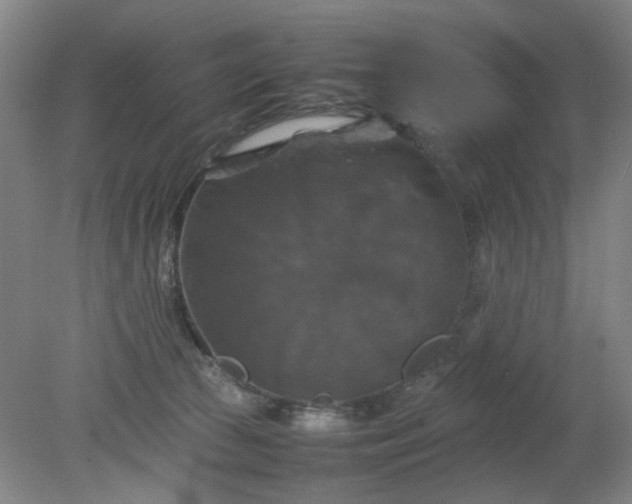 X0000079320177200612011851