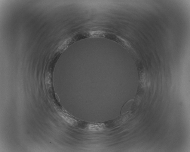 X0000079320571200612011845