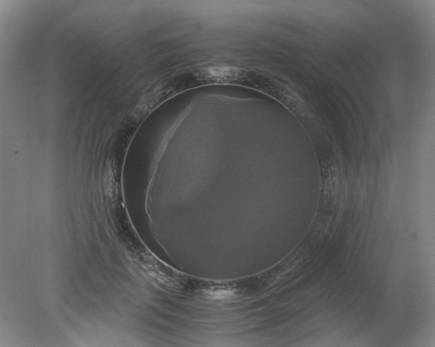 X0000079320651200612011843