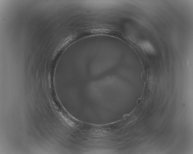 X0000079320729200612011841