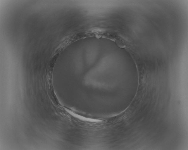 X0000079321397200612011830