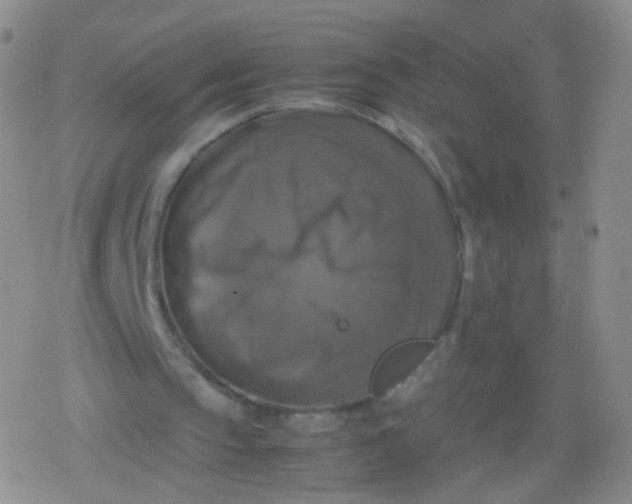 X0000079320145200612081943