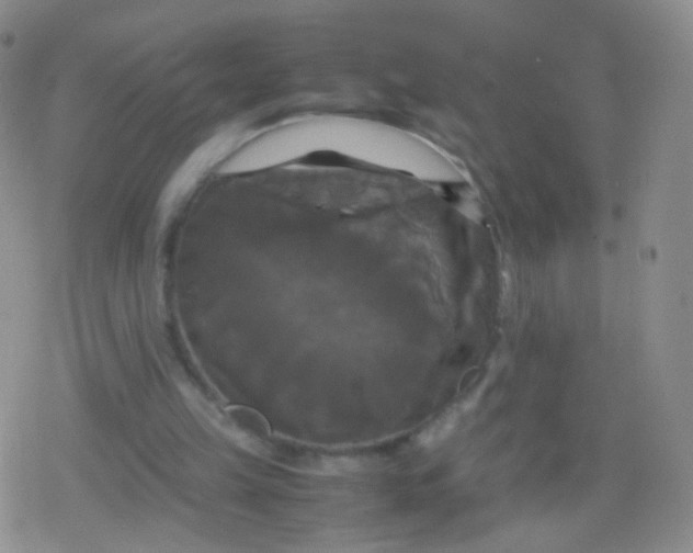 X0000079320149200612081943