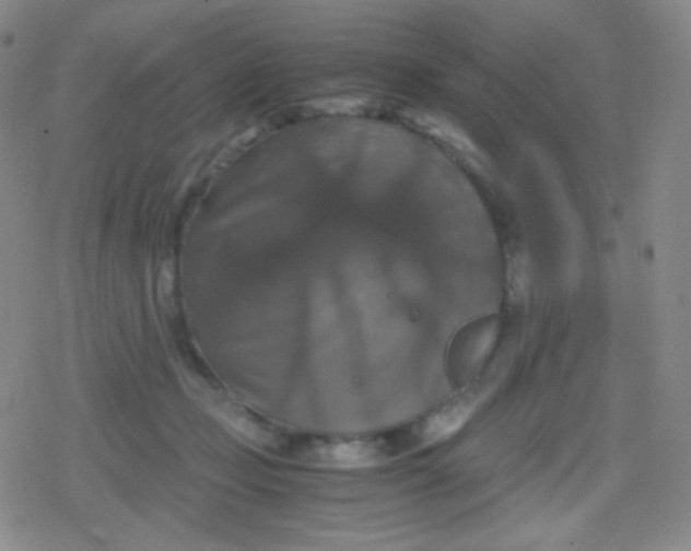 X0000079320365200612081940