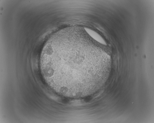 X0000079320499200612081938