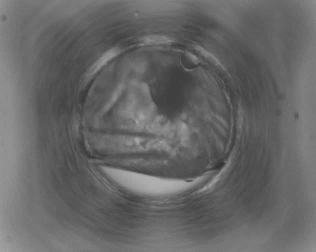 X0000079321401200612081922