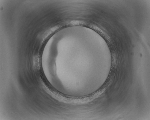 X0000079320016200612151829