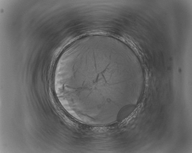 X0000079320145200612151826