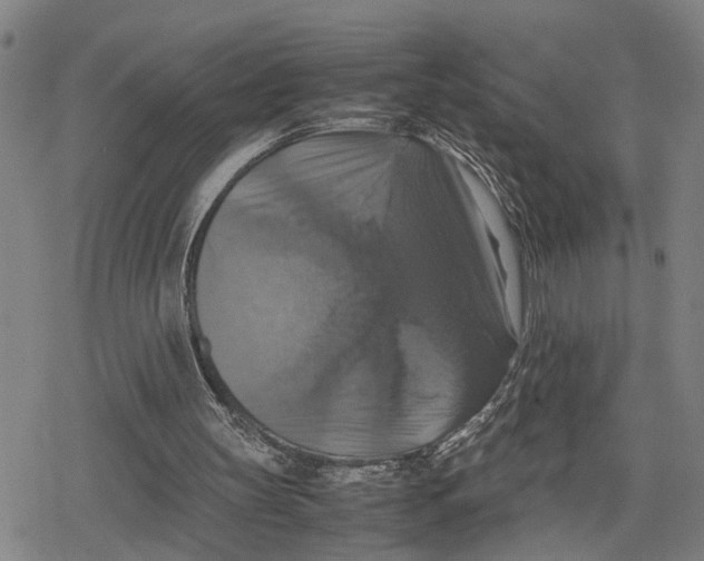 X0000079320147200612151826