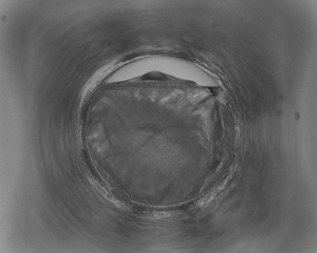 X0000079320149200612151826