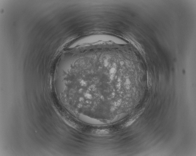 X0000079320157200612151826