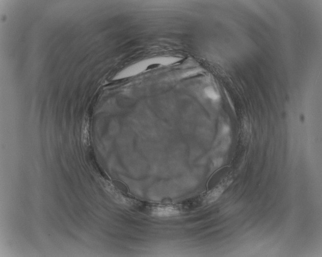 X0000079320177200612151826