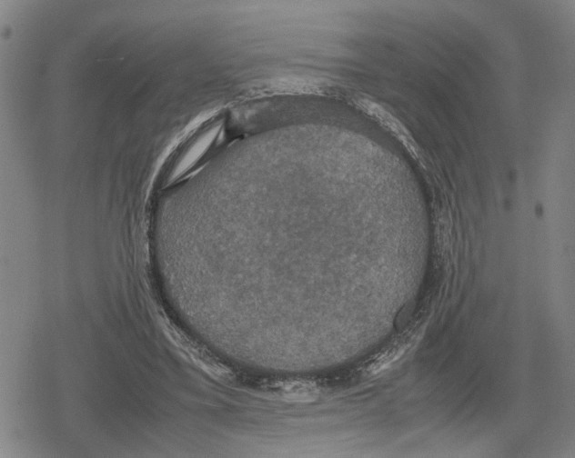 X0000079320395200612151822