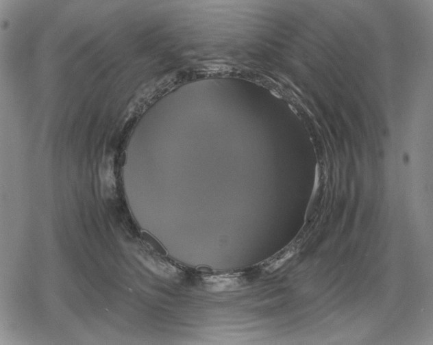 X0000079320516200612151820