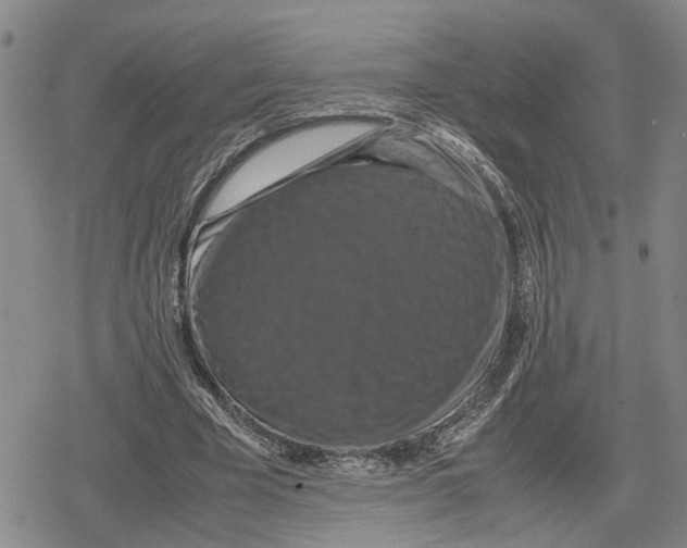 X0000079320585200612151819