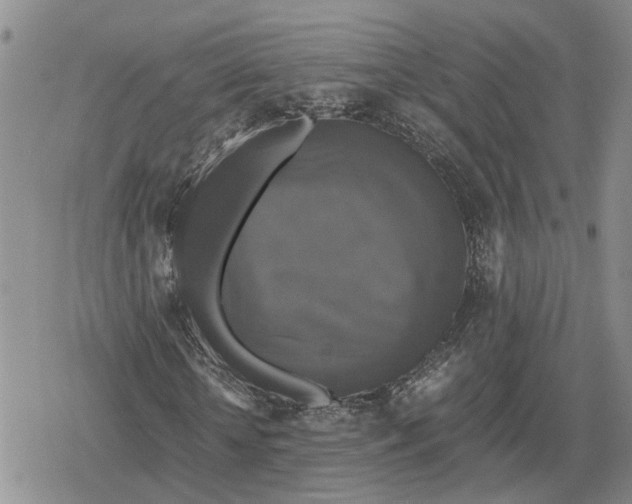 X0000079320818200612151815