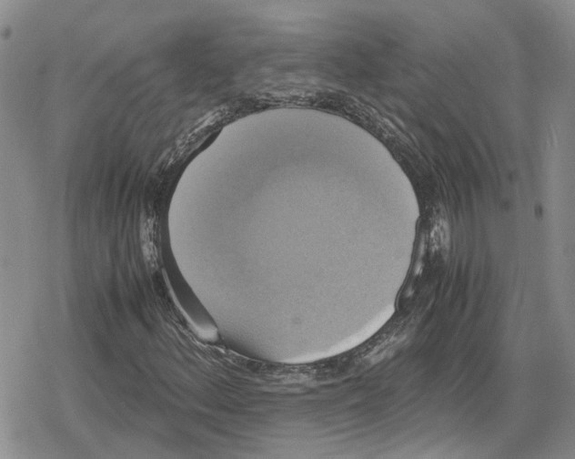 X0000079321156200612151810