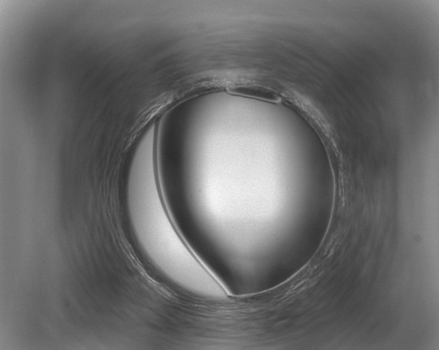 X0000079330105200611171006
