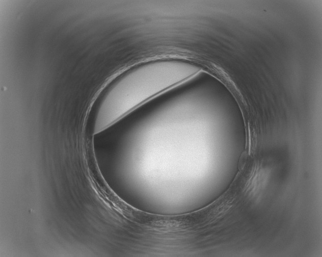 X0000079330435200611171000