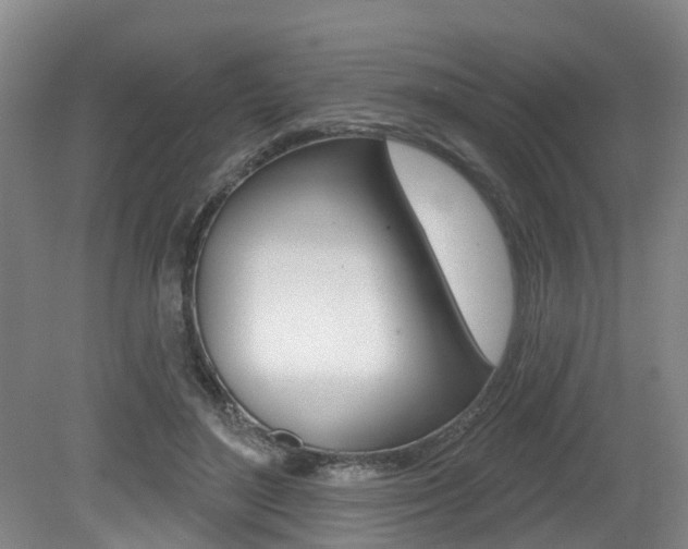X0000079330500200611171000