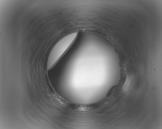 X0000079330657200611170957