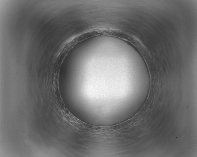 X0000079331016200611170951