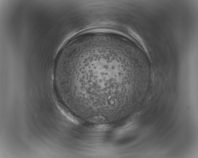 X0000079330059200611171200
