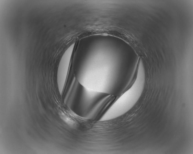 X0000079331300200611171138